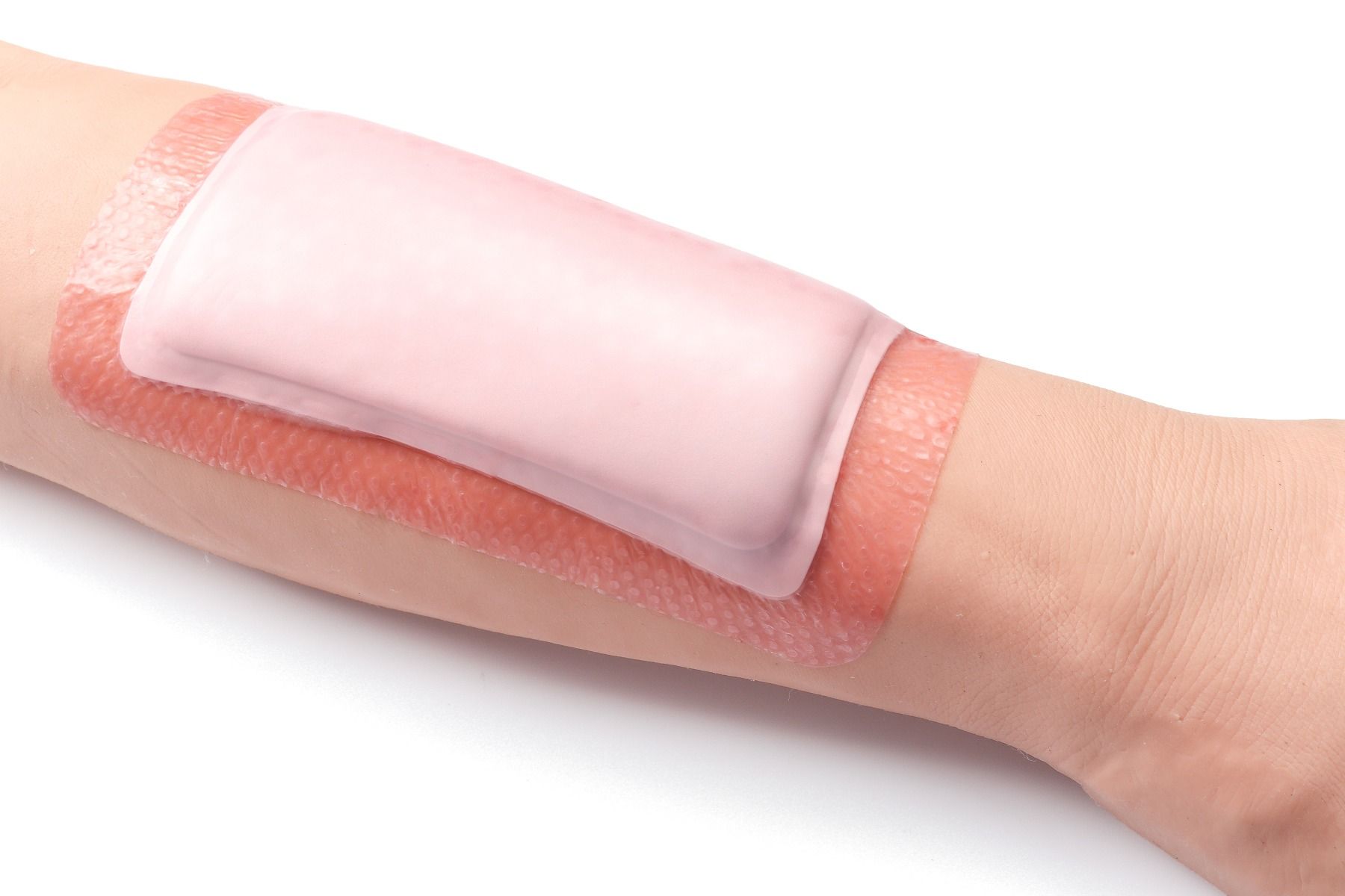 WUNDLINE SHAUKON SILICONE FOAM DRESSING / BORDERED photo