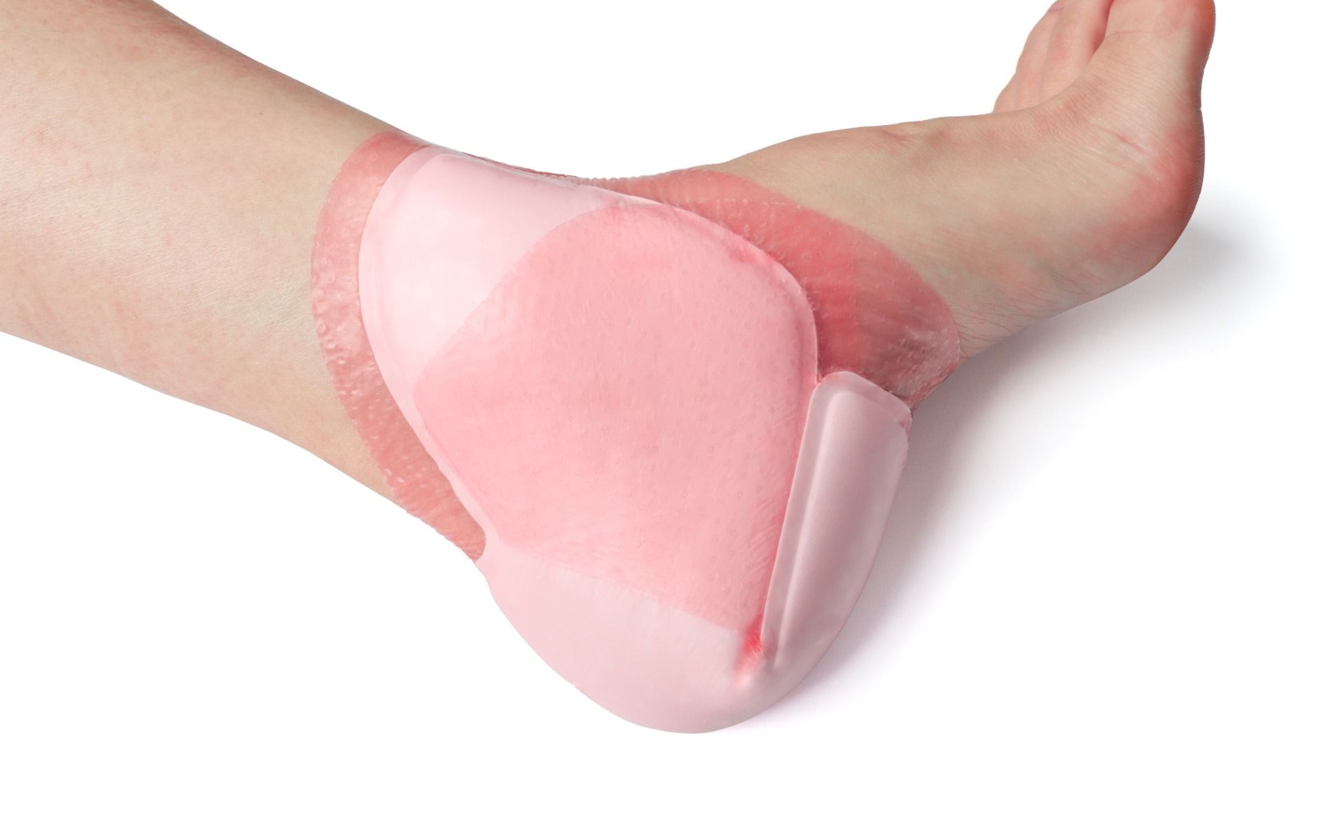 WUNDLINE SHAUKON SILICONE FOAM DRESSING / BORDERED photo